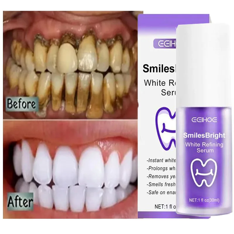 Teeth Whitening In Korea - Oczyszczanie zębów Wybielająca pasta do zębów