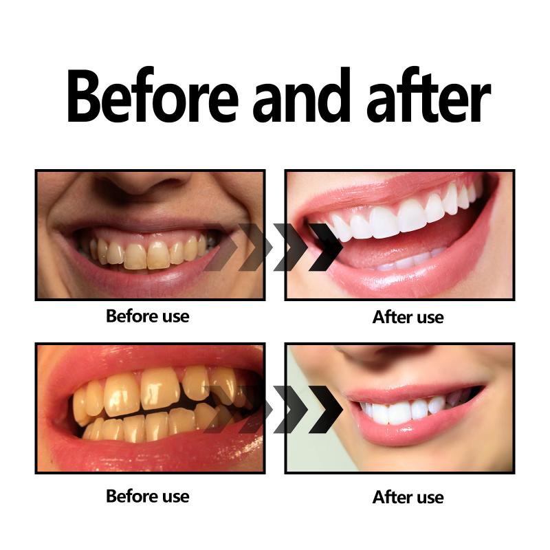 Proszek do wybielania zębów z  – Teeth Whitening With Baking Soda recenzja i cena