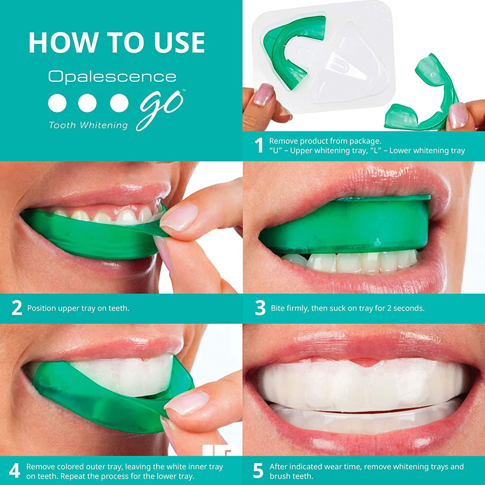 Nadtlenek wodoru do wybielania – Teeth Whitening In Office recenzja i cena