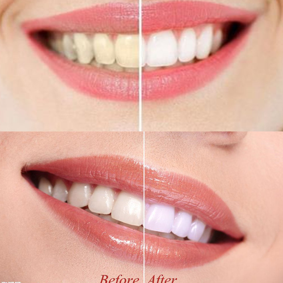 Bambusowy węgiel drzewny zęby  – Teeth Whitening Q&M recenzja i cena