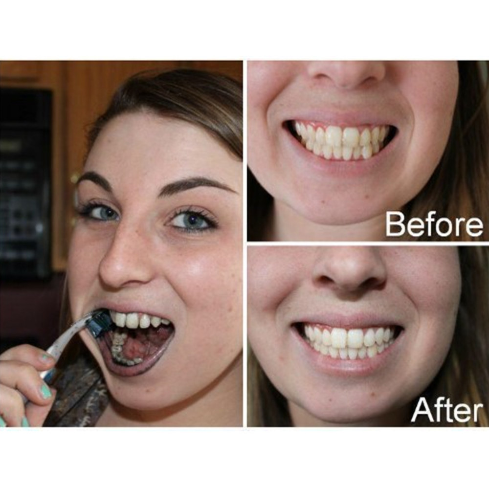 Bambusowy węgiel drzewny zęby  – Teeth Whitening Q&M recenzja i cena