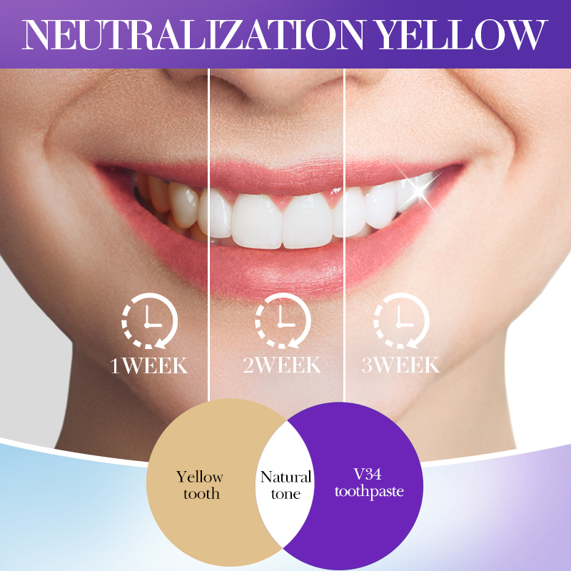 SADOER V34 Pasta do zębów usuw – Teeth Whitening Hismile recenzja i cena