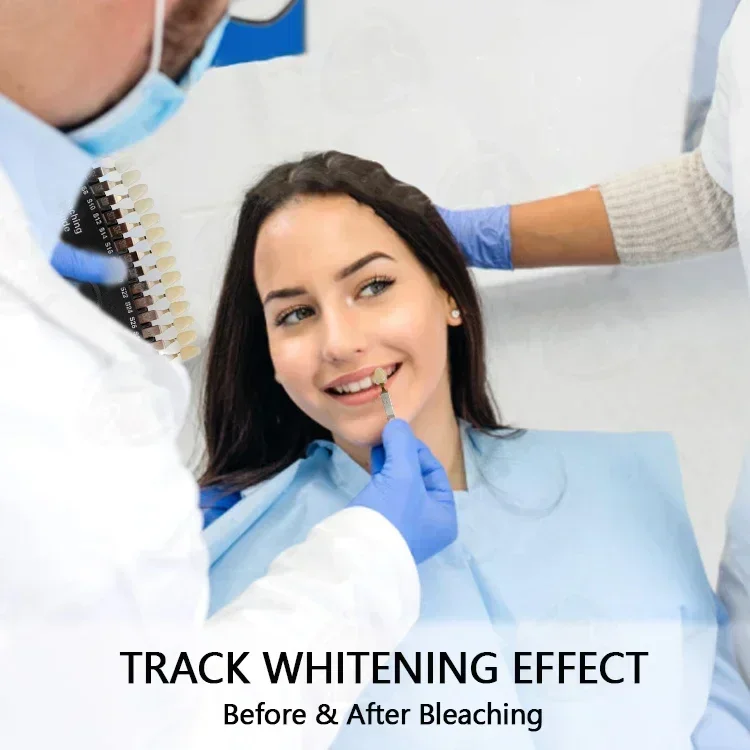 Profesjonalne wybielanie zębów – Teeth Whitening Shade Guide recenzja i cena