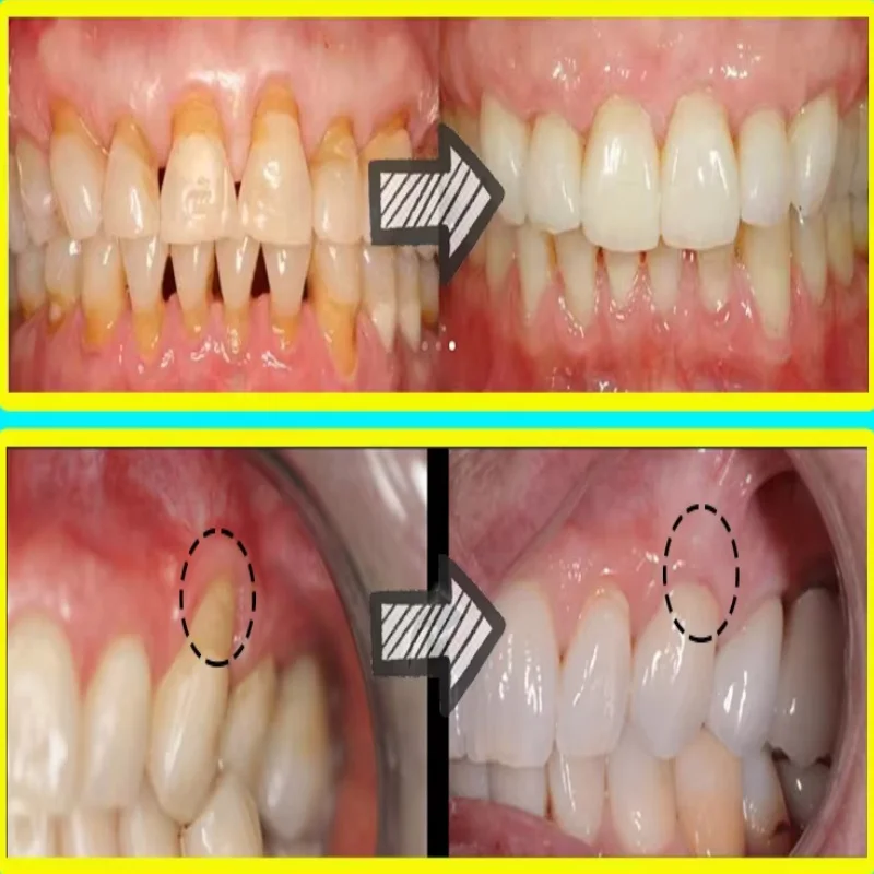 Szybkie Serum do Łagodzenia Za – Teeth Whitening With Baking Soda recenzja i cena