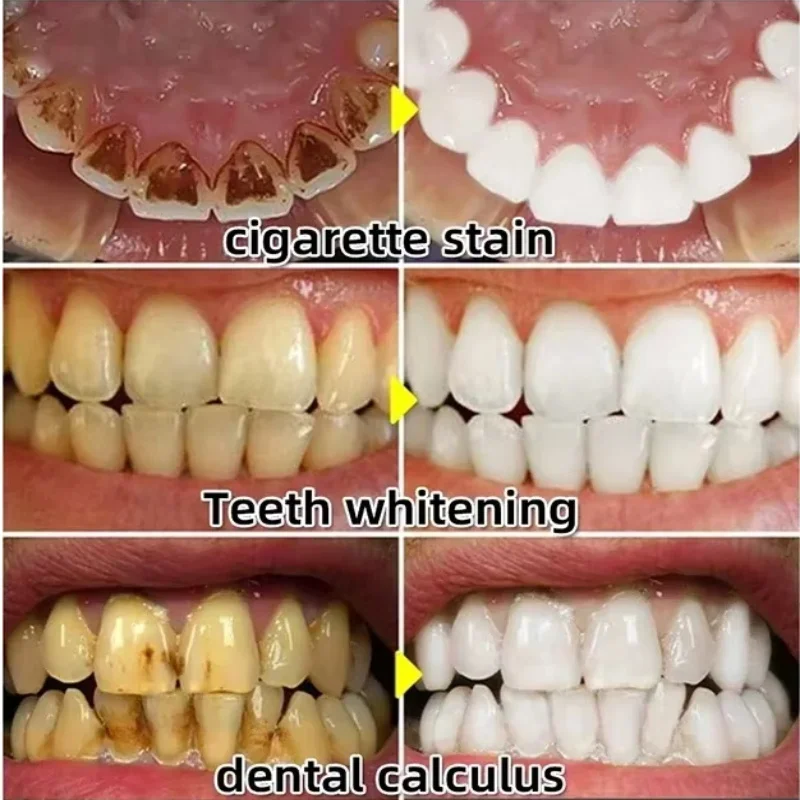 Szybkie Serum do Łagodzenia Za – Teeth Whitening With Baking Soda recenzja i cena