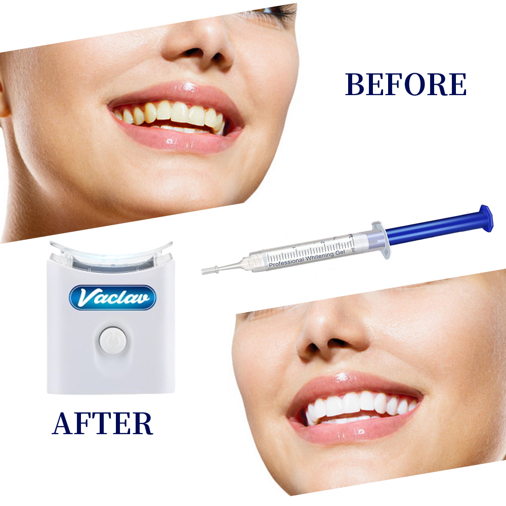 Żel do wybielania zębów w strz – Teeth Whitening With Baking Soda recenzja i cena
