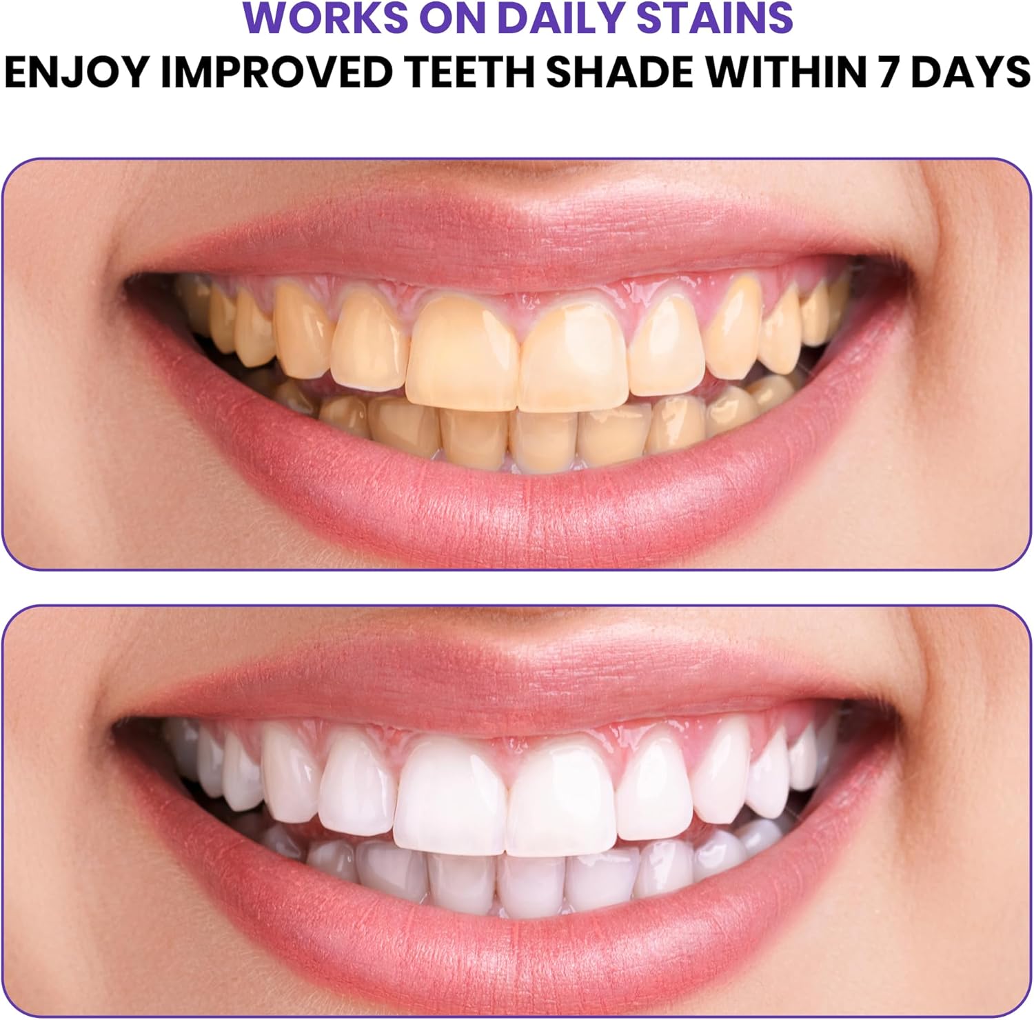 Zaawansowane fioletowe paski d – Teeth Whitening In Office recenzja i cena