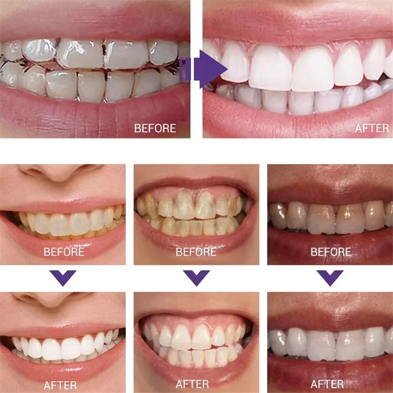 Pasta do czyszczenia i wybiela – Teeth Whitening In Korea recenzja i cena