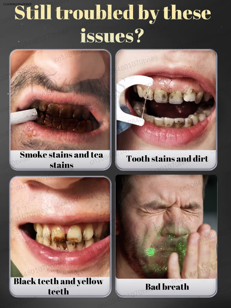 POZOAMIS 30% Hydroxyapatite Pa – Teeth Whitening In Office recenzja i cena