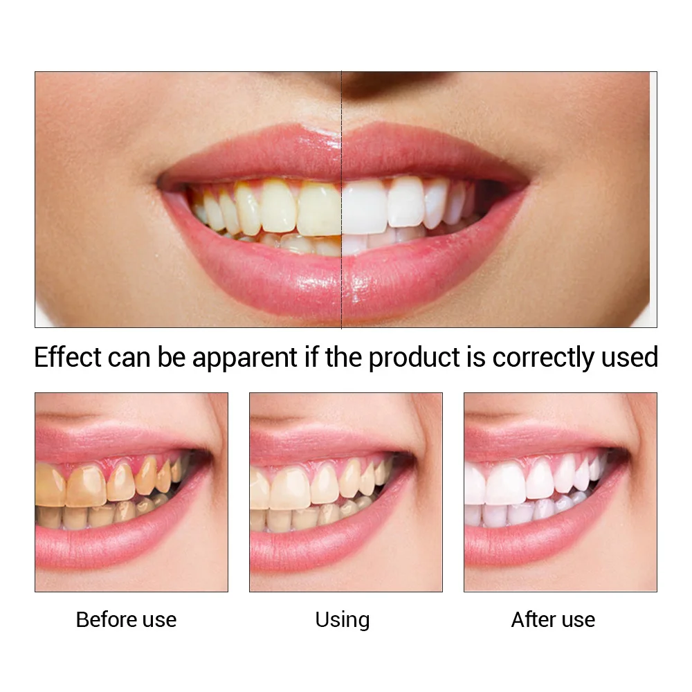 FTEENPLY esencja do wybielania – Teeth Whitening Q&M recenzja i cena