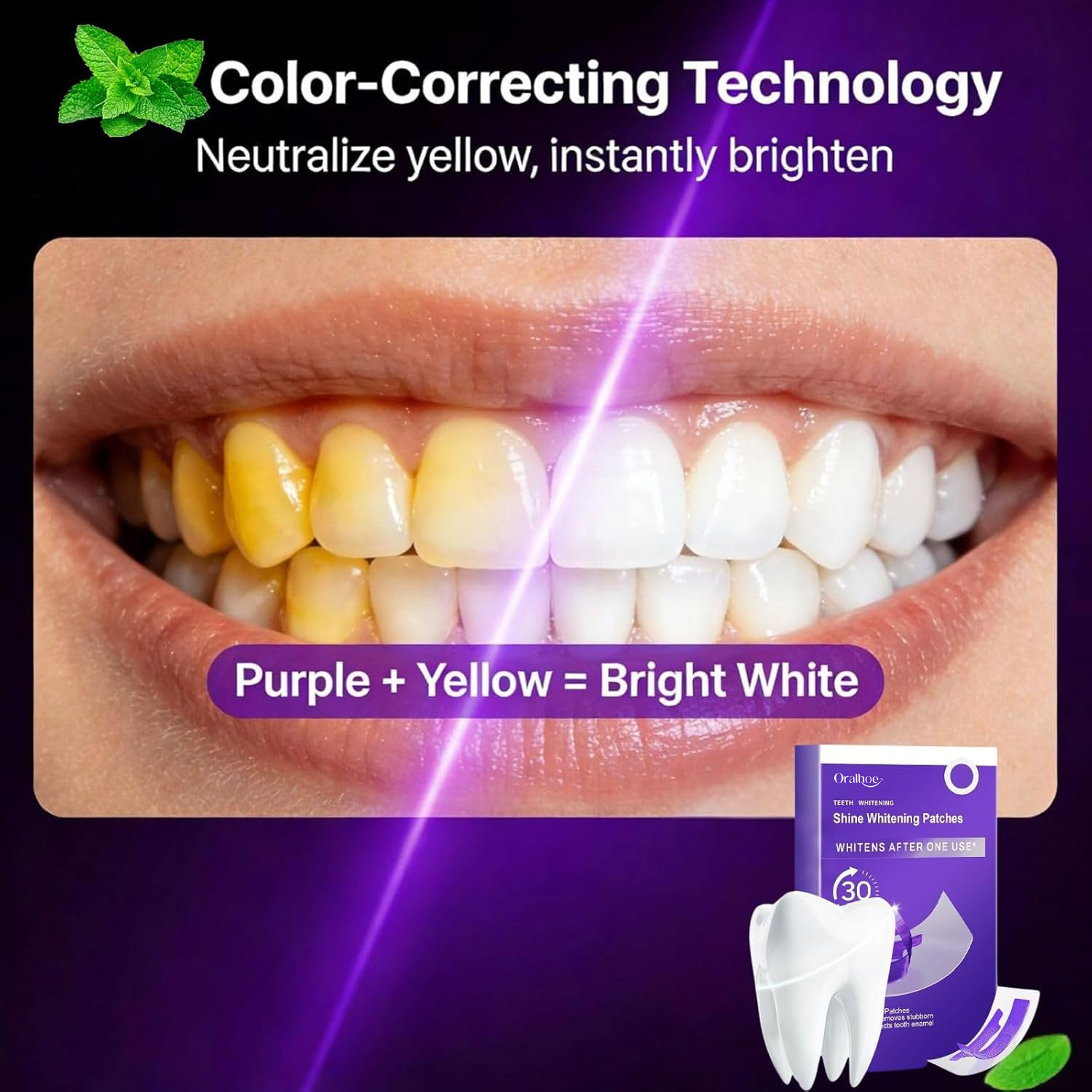 Fioletowy Zestaw do Wybielania – Teeth Whitening In Office recenzja i cena