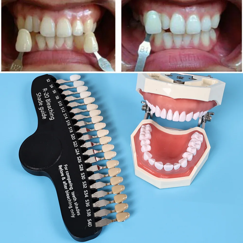 ELIJAH R-20 Kolorówka do Wybie – Teeth Whitening Shade Guide recenzja i cena