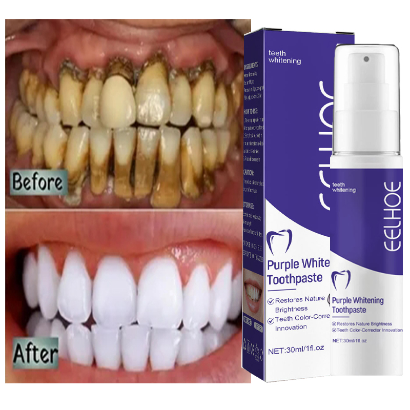 1 szt. Wybielająca wybielająca – Teeth Whitening In Korea recenzja i cena