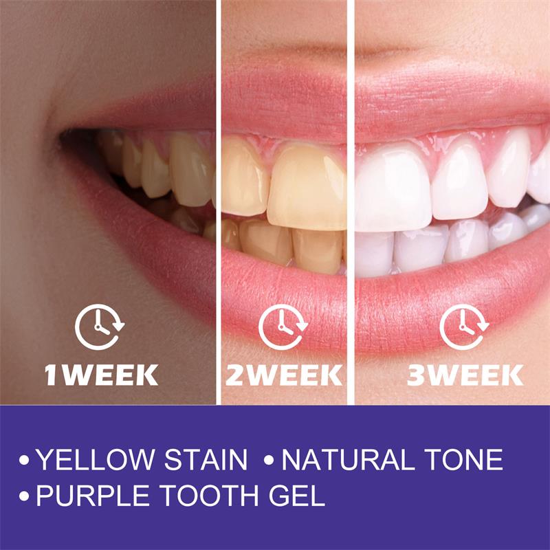 1 szt. Wybielająca wybielająca – Teeth Whitening In Korea recenzja i cena
