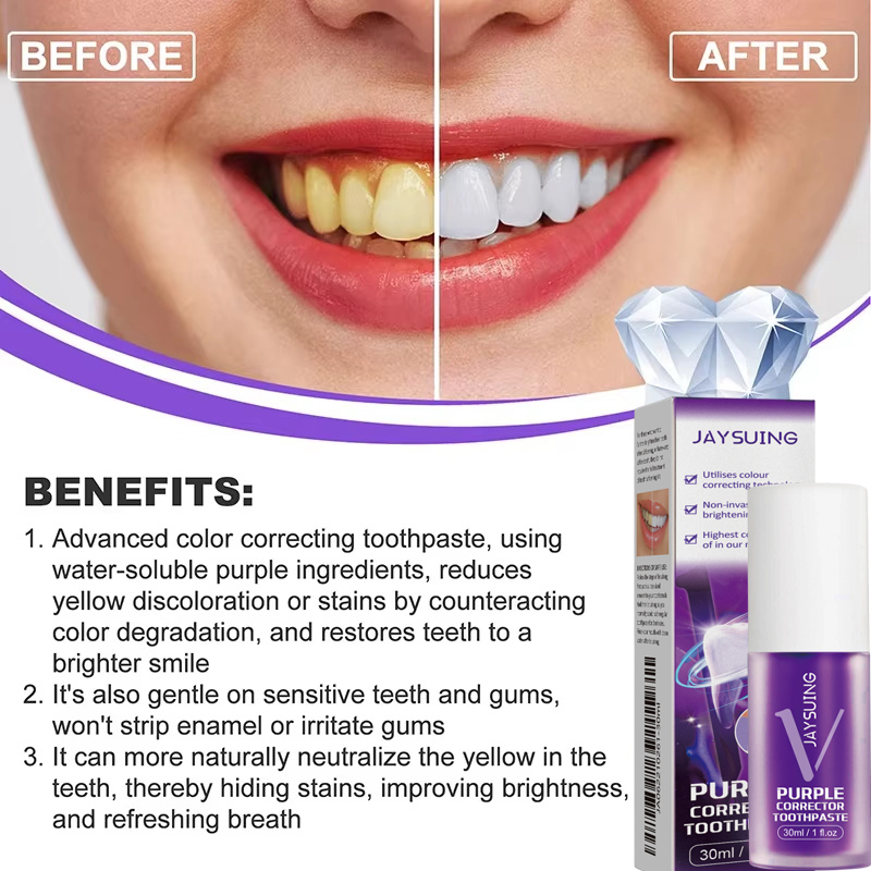 Pasta do zębów wybielająca, że – Teeth Whitening In Korea recenzja i cena