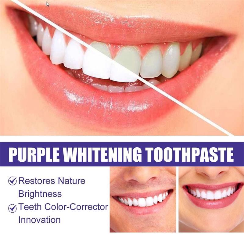 Pasta do zębów wybielająca, że – Teeth Whitening In Korea recenzja i cena