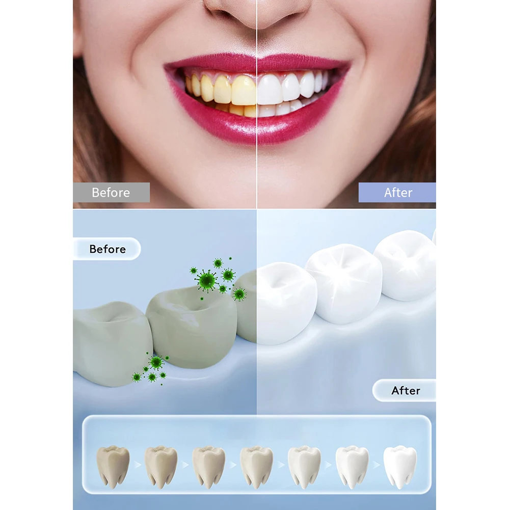 1 szt. Inteligentna lampa LED  – Teeth Whitening In Office recenzja i cena
