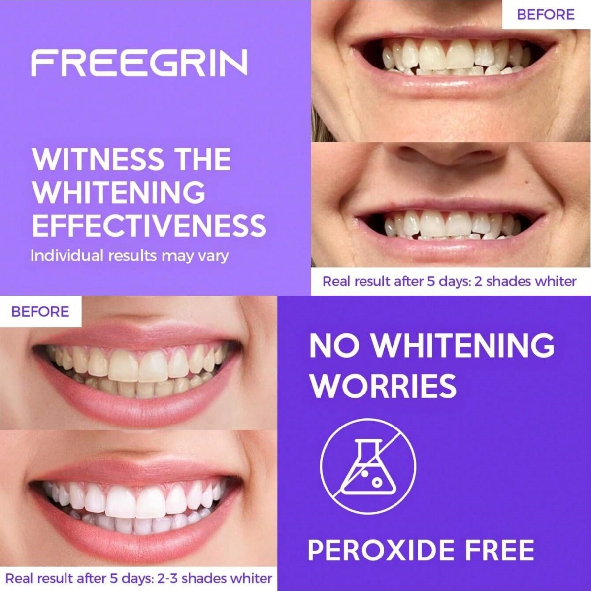 Naklejki wybielające do zębów  – Teeth Whitening In Office recenzja i cena