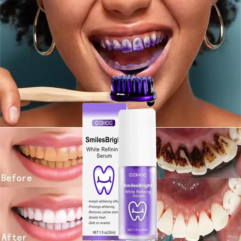 Oczyszczanie zębów Wybielająca – Teeth Whitening In Korea recenzja i cena