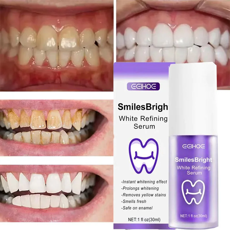 Oczyszczanie zębów Wybielająca – Teeth Whitening In Korea recenzja i cena